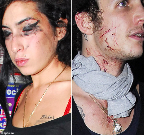Amy Winehouse bloody
