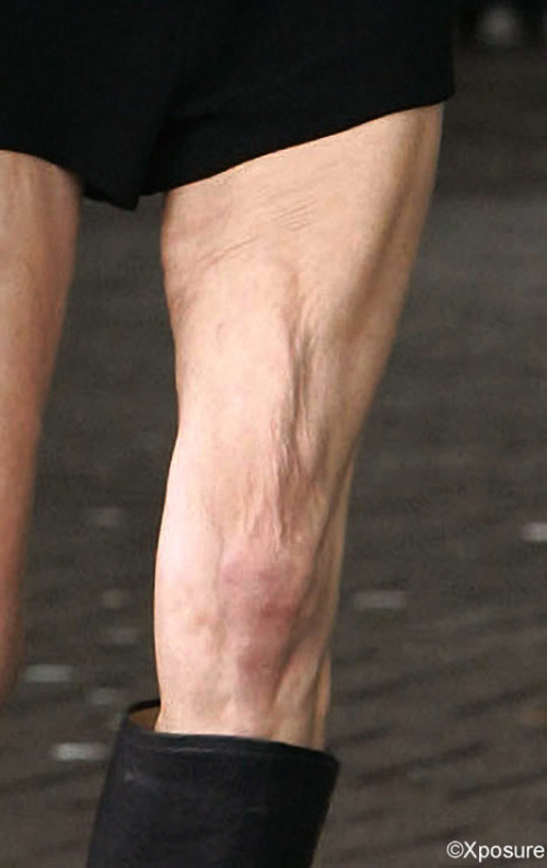 Kate Moss knees