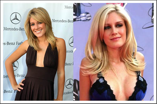 Heidi Montag before and after