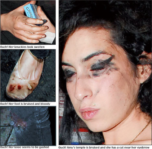 Amy Winehouse fight